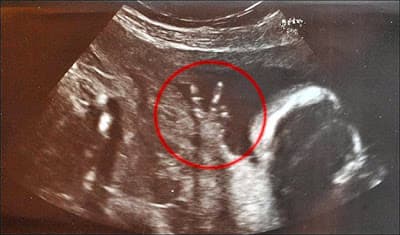 Asi se Forja una Leyenda!!!