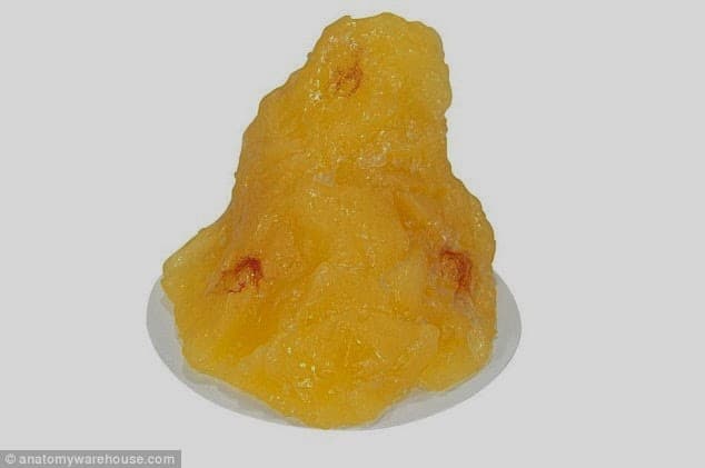 Una libra de grasa humana por $23