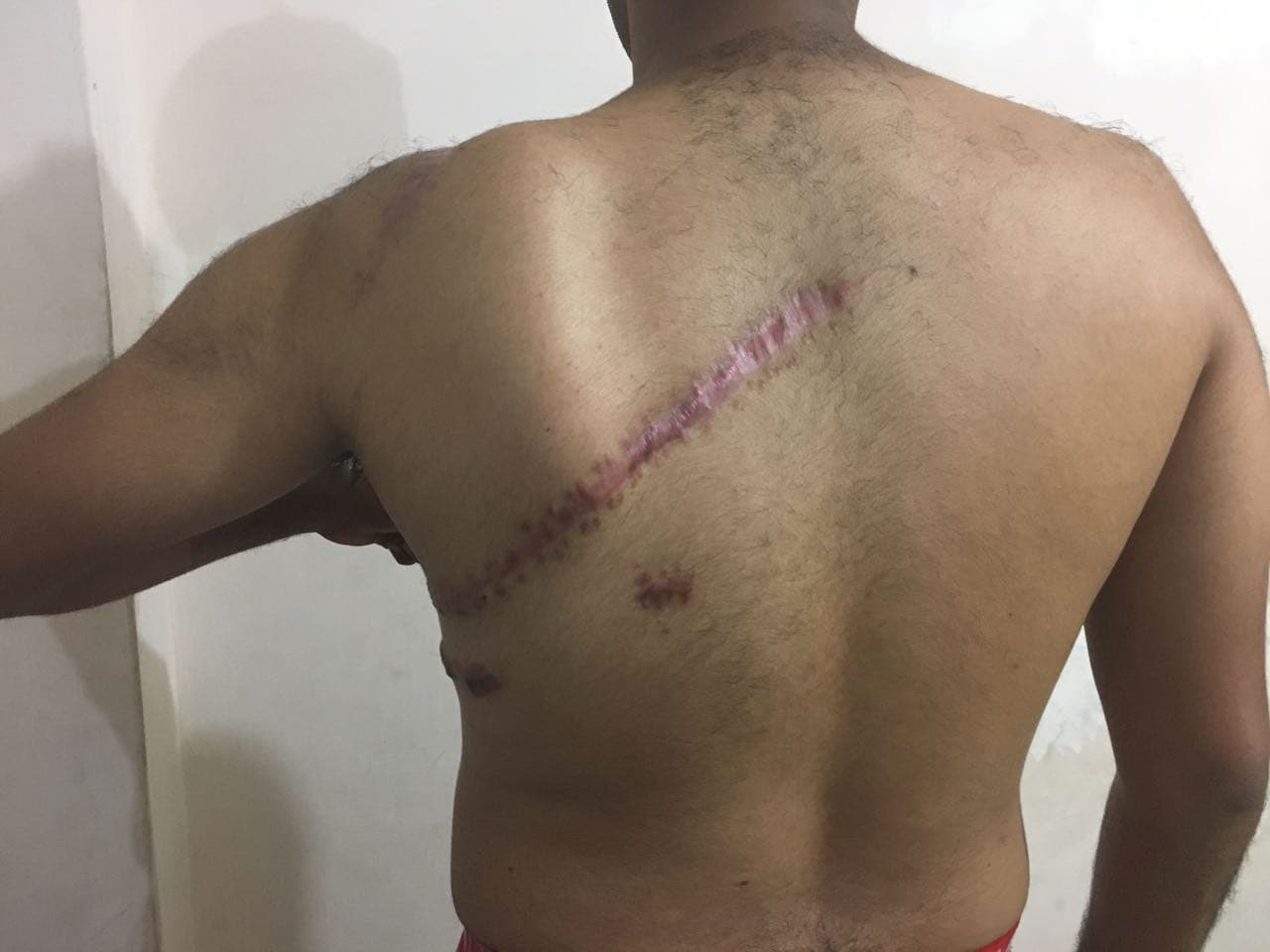 Habla Josue Veliz, la víctima de ataques con cuchillo en estadio de Barcelona (entrevista de audio)